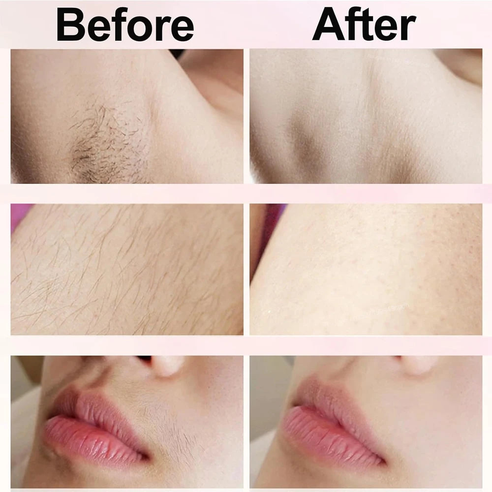 Pijnloze elektrische epilator voor vrouwen voor een gladde en zachte huid
