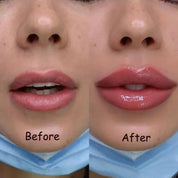 Neuer Lip Plump